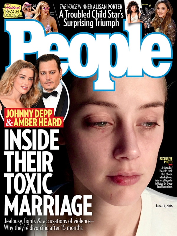 El rostro golpeado de Amber Heard llegó a la portada de la revista People