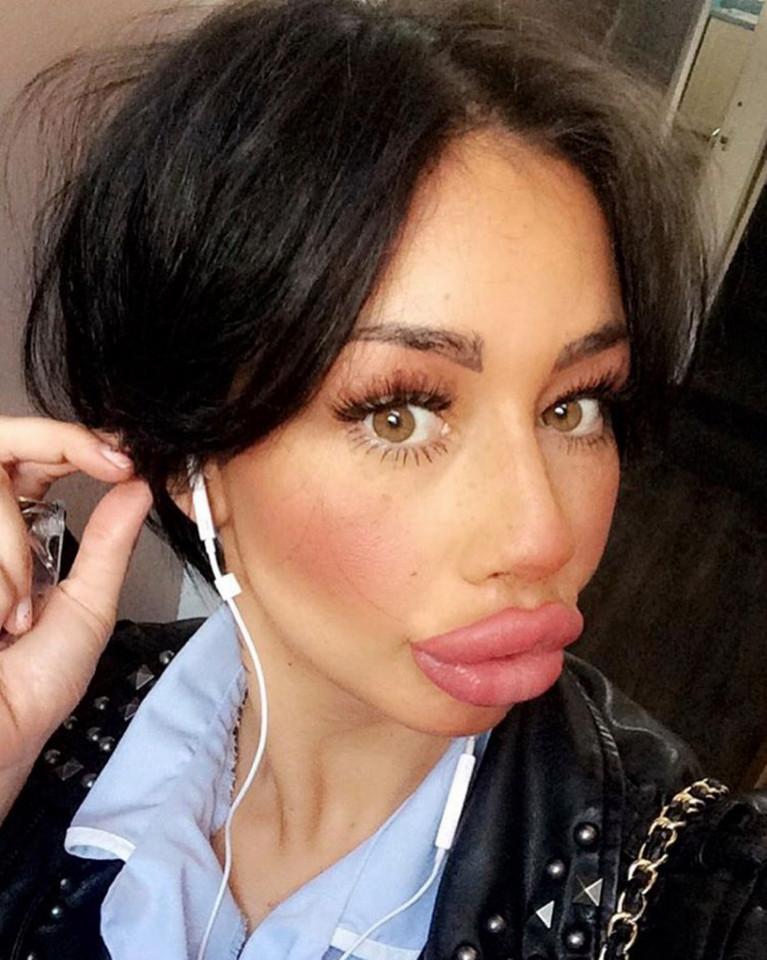Alia Byrne, 30, from Liverpool who has had a massive amount of filler injected into her lips, August 2016. The single Mum-of-one splashes out on the beauty treatment to give herself the trout pout she's always dreamed of. In just under a year, the part-time care worker from Liverpool has had over 6.5ml of dermal fillers injected into her lips  splurging GBP250.00 per session (GBP1,625 in total) and now boasts the enormous smackers she always desired. Alia hopes to go even bigger with her lips and wants a further 1ml of fillers injected. Shes say the procedure is painful but worth it. Although some may feel that Alias cosmetically enhanced lips are excessive, Alia says that her new pout has made her happier than ever and she has even won thousands of admirers on social media. .. SEE COPY  PIC BY NEWS DOG MEDIA  +44 (0)121 517 0019